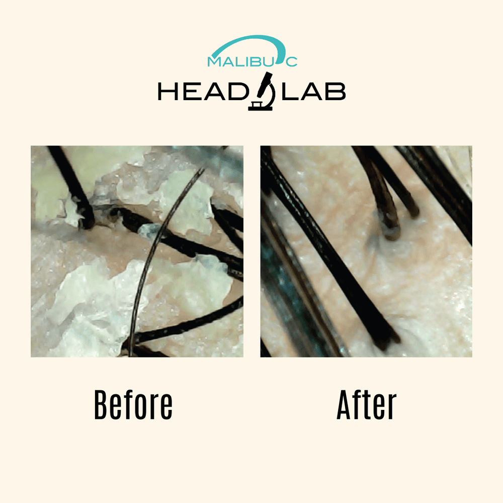Head Lab® Intro